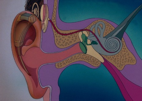 Luniaudio: la soluzione migliore per il tuo udito disegno cavità auricolare per luniaudio